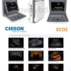 Portable Ultrasound Machine; Chison ECO 2 price in Bangladesh