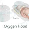 Neonatal Oxygen Hood india