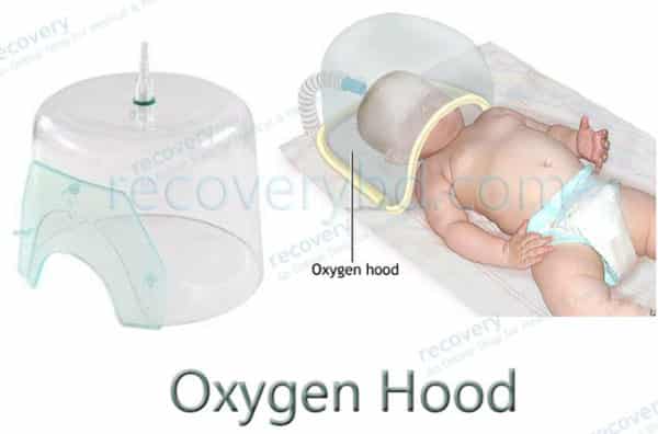 Neonatal Oxygen Hood india