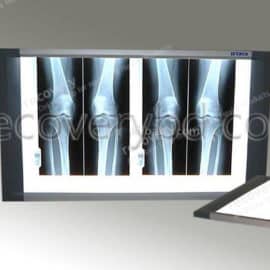 LED X-Ray View Box; X-Ray Film Viewer (LED type)