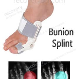 Bunion Splint; Bunion Corrector; Big Toe Splint