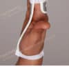 Finger Extension Splint