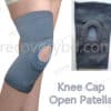 Knee Cap Open Patella