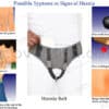 hernia belt