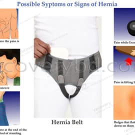 Hernia Belt