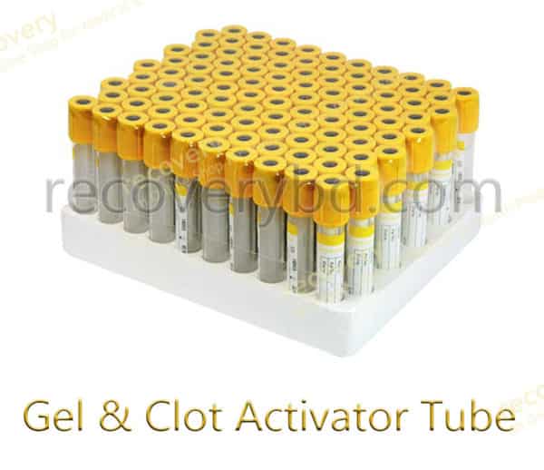 gel and clot activator tube