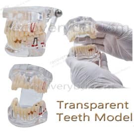 Transparent Teeth Model; Teeth Model in Bangladesh