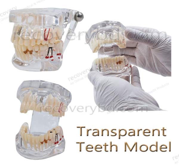 transparent teeth model