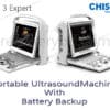 portable ultrasound machine with battery backup