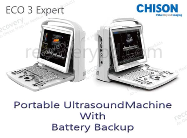 portable ultrasound machine with battery backup