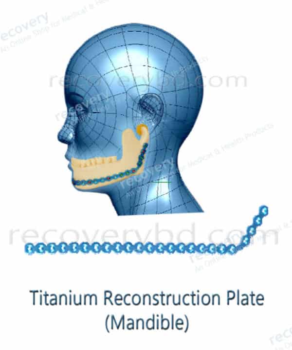 reconstruction plate