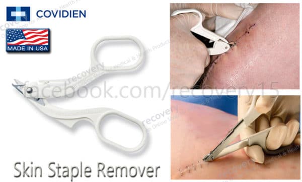 skin staple remover