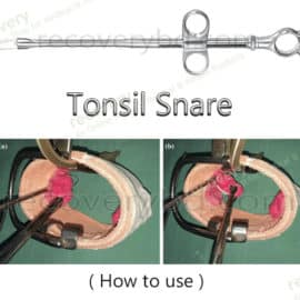 Tonsil Snare; EVE’s Tonsil Snare; Tonsil Surgery Instrument