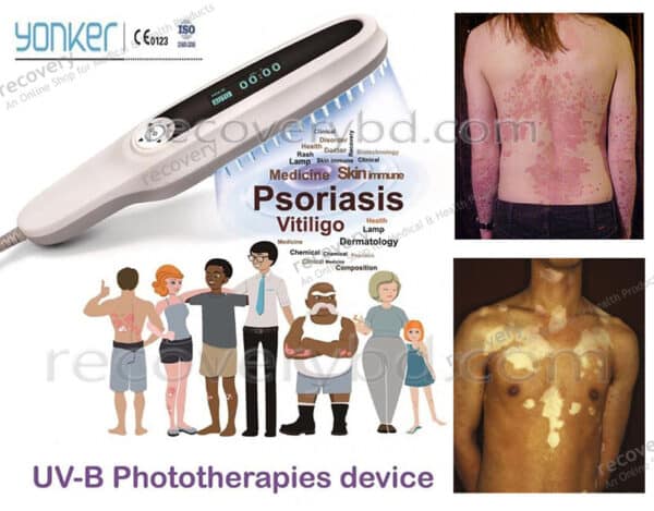 UVB Phototherapy Device