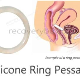 Silicone Ring Pessary; Silicone Vaginal Ring Pessary