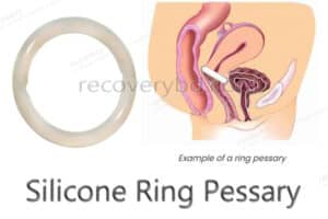 Silicone Ring Pessary