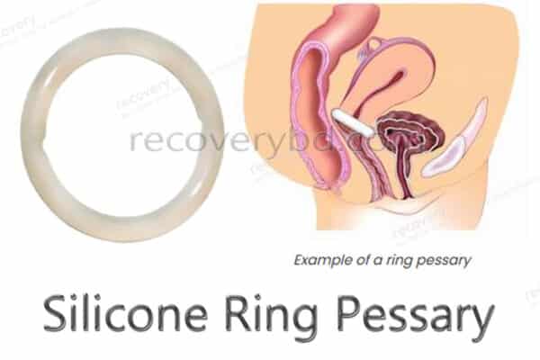 Silicone Ring Pessary