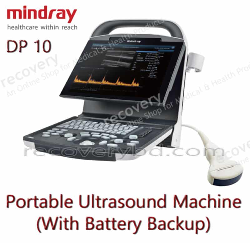 Portable Ultrasound Machine with Battery Backup